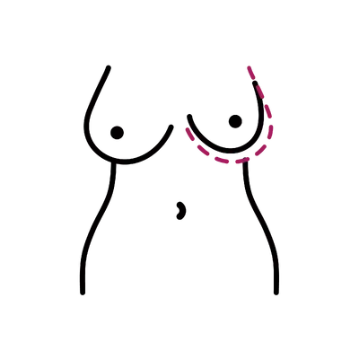 Breast Asymmetry Correction