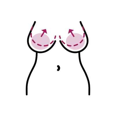 Breast Implant Revision