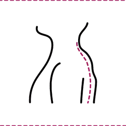 Buffalo Hump Removal