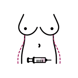 Fat Transfer to Hips