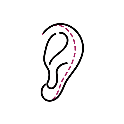 Otoplasty in Thailand: Cost, Top Surgeons & Hospitals