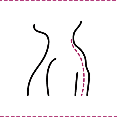 Buffalo Hump Removal in Thailand: Cost, Top Surgeons & Hospitals