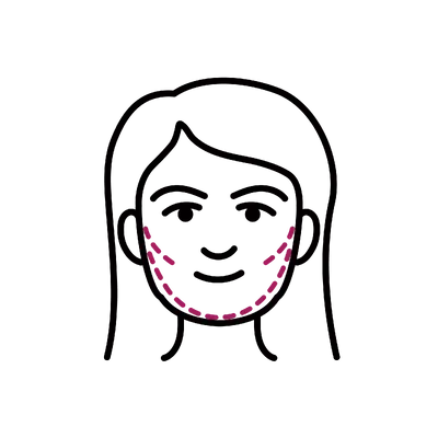 Buccal Fat Removal in Thailand: Cost, Top Surgeons & Hospitals