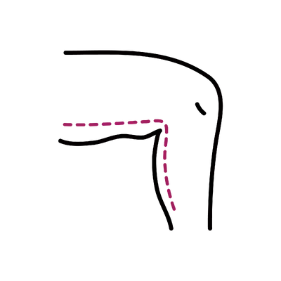 Thigh Liposuction in Thailand: Cost, Top Surgeons & Hospitals