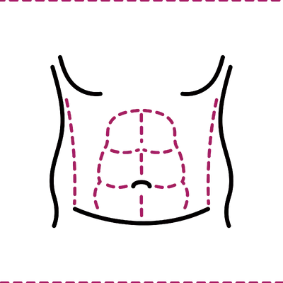 Six Pack Liposuction in Thailand: Cost, Top Surgeons & Hospitals