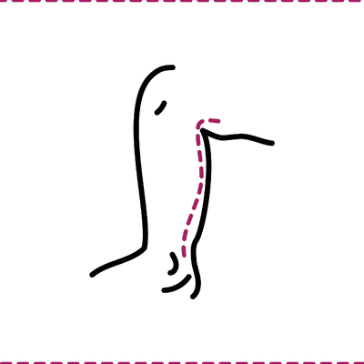 Calves & Ankles Liposuction in Thailand: Cost, Top Surgeons & Hospitals