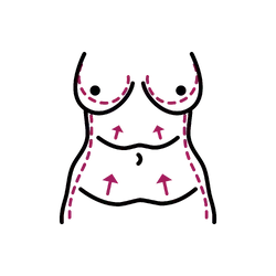 Post-Bariatric Body Contouring