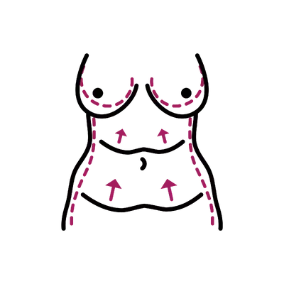 Post-Bariatric Body Contouring