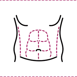 Six Pack Liposuction