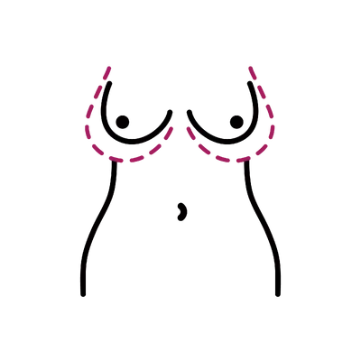 Tuberous Breast Correction