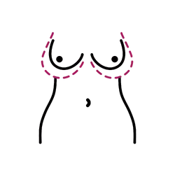 Tuberous Breast Correction